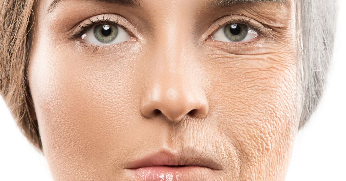 Tratamiento de bioestimulación celular para el envejecimiento prematuro